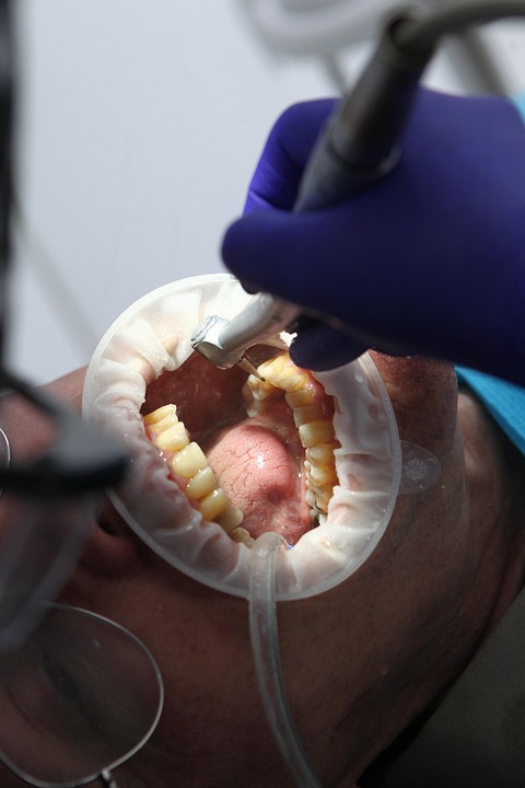 Dental